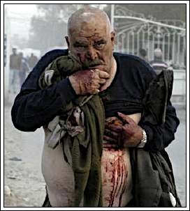 injured Iraqi victim